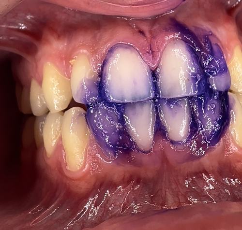 Purple Toothpaste