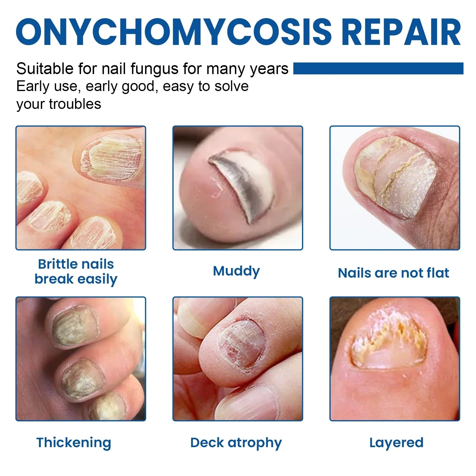 Fungus Nail Repair Patches 60pcs