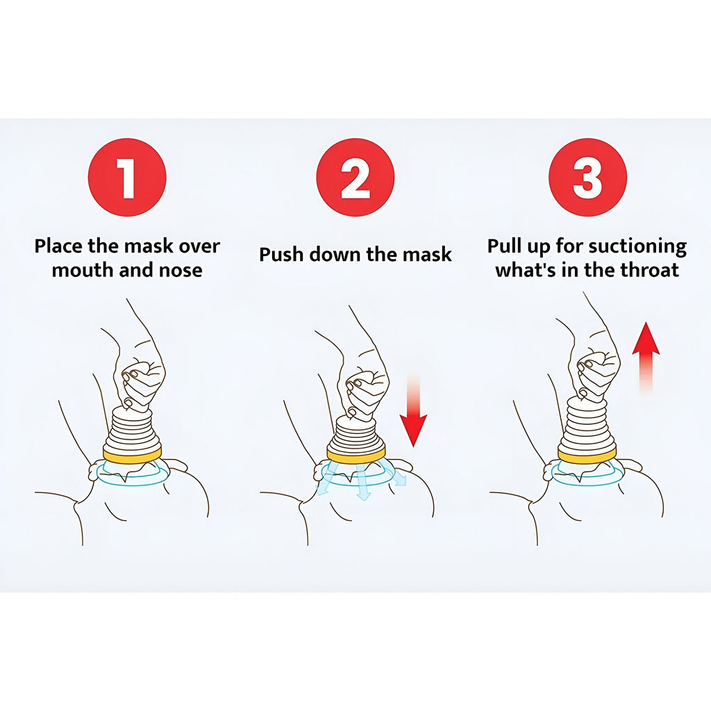 AirwayUnblocker - Reusable Emergency Airway Unblocker And Clearing Device Kit